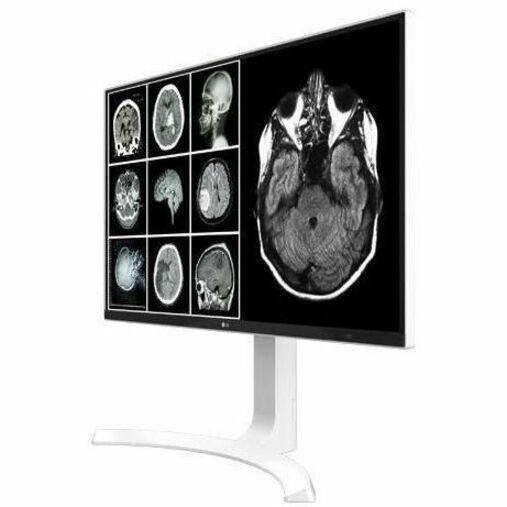 LG MED 27IN IPS 8MP 4K CLINICAL