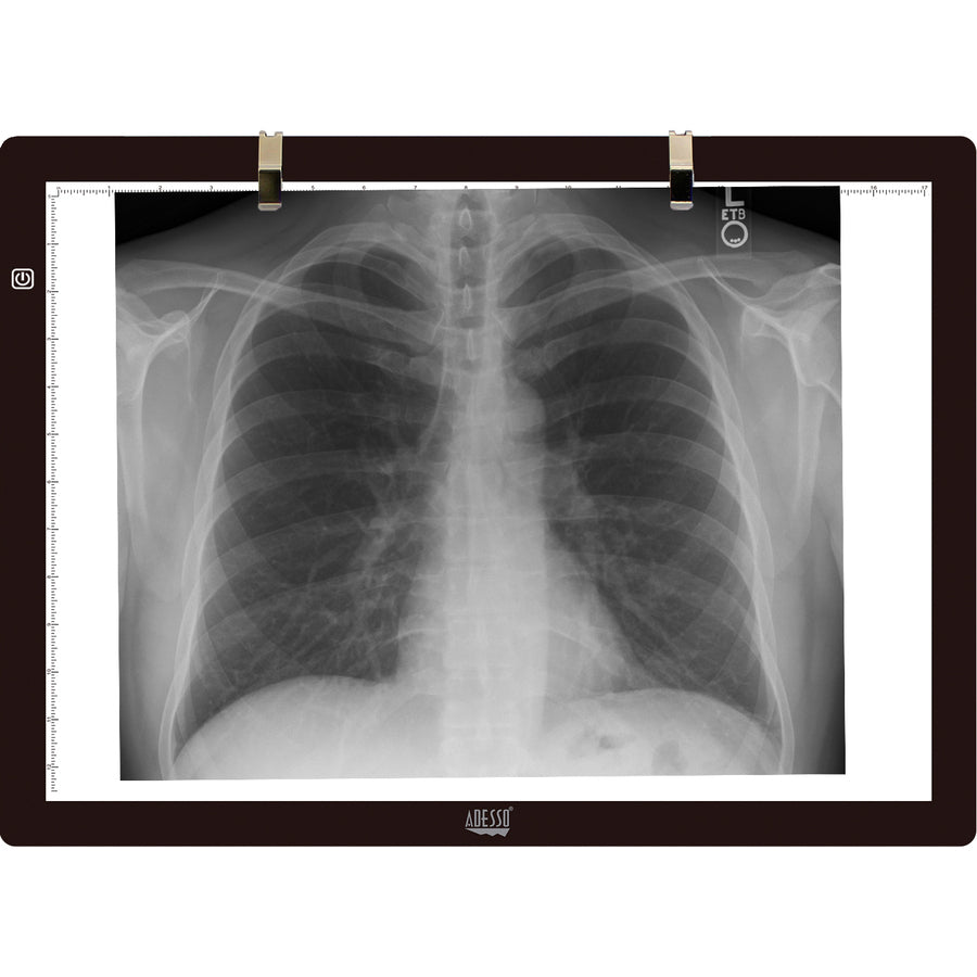 Adesso CyberPad P2- 12" x 17" LED Light Tracing Pad