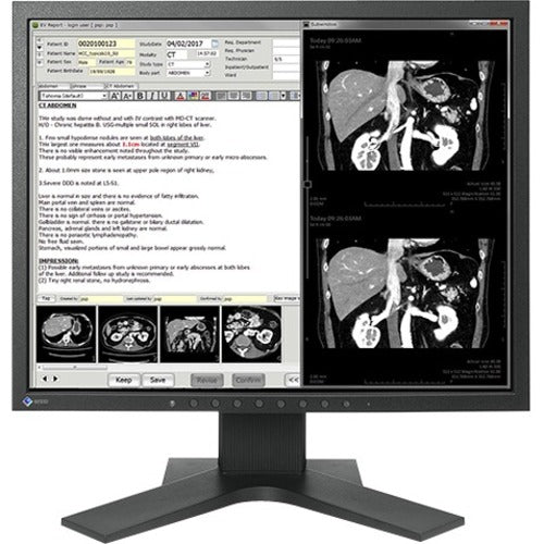 19IN CLR TFT LCD DICOM