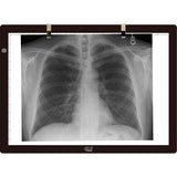 Adesso CyberPad P2- 12" x 17" LED Light Tracing Pad