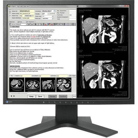 19IN CLR TFT LCD DICOM