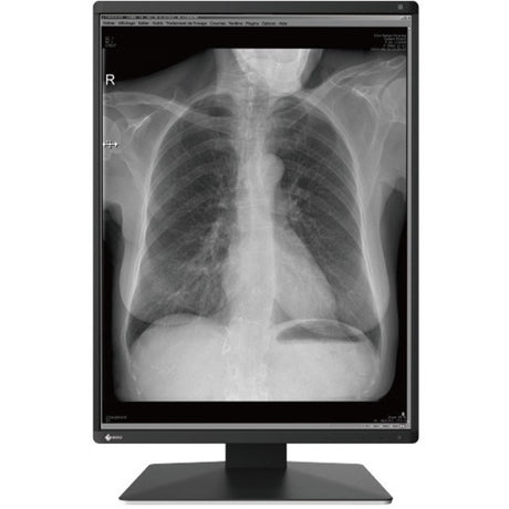 EIZO RadiForce RX370-BK 21" Class QXGA LCD Monitor - 3:4 - Black