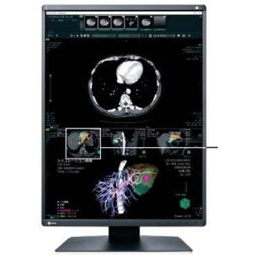 EIZO RadiForce RX370-BK 21" Class QXGA LCD Monitor - 3:4 - Black