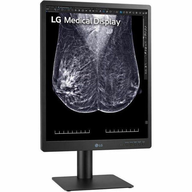 LG 21HQ613D-B 21" Class QSXGA LCD Monitor - 4:5 - Black